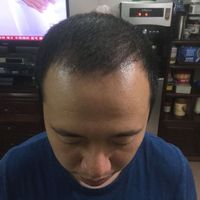 發(fā)際線用戶圖片