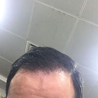 發(fā)際線用戶圖片