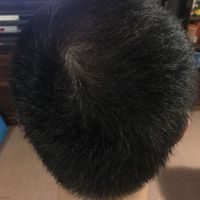 發(fā)際線用戶圖片