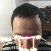 發(fā)際線用戶圖片