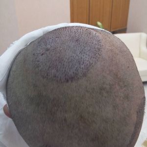 稀少加密分享社区