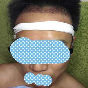 发际线分享社区