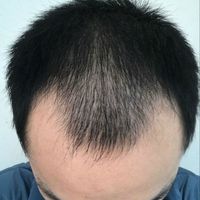 <font color="red">稀少加密</font>用戶(hù)圖片