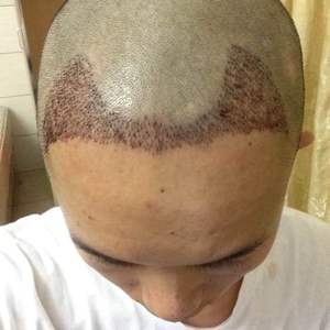 发际线分享社区