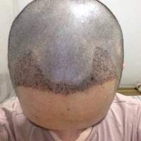 發(fā)際線用戶圖片