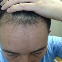 發(fā)際線用戶圖片