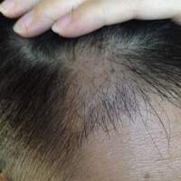 發(fā)際線用戶圖片