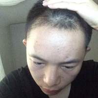 發(fā)際線用戶圖片
