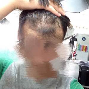发际线分享社区