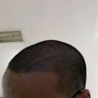發(fā)際線用戶圖片