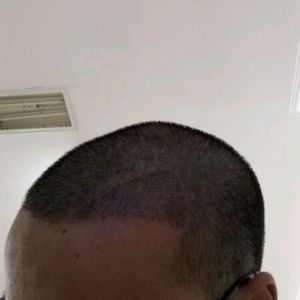 发际线分享社区
