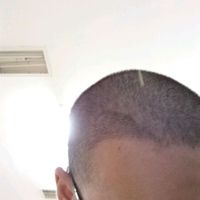 發(fā)際線用戶圖片