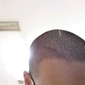 发际线分享社区