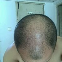 發(fā)際線用戶圖片
