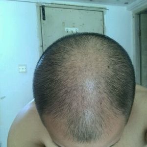发际线分享社区