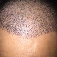 發(fā)際線用戶圖片