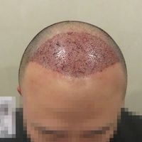 發(fā)際線用戶圖片