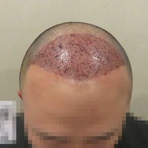 发际线分享社区