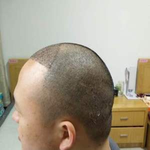 发际线分享社区