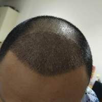 發(fā)際線用戶圖片