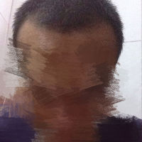 發(fā)際線用戶圖片