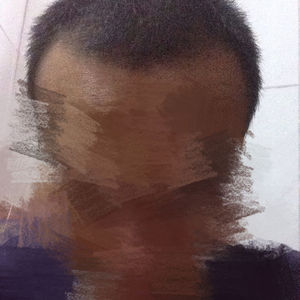 发际线分享社区
