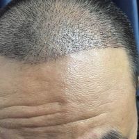 發(fā)際線用戶圖片