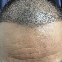 發(fā)際線用戶圖片