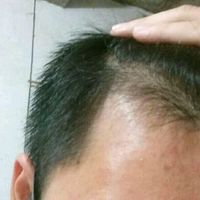 生發(fā)養(yǎng)護用戶圖片