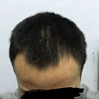 發(fā)際線用戶圖片