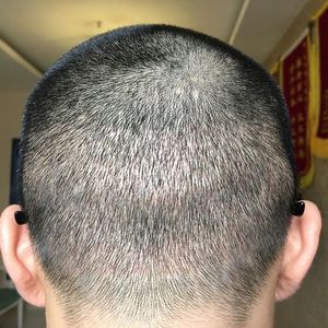 发际线分享社区