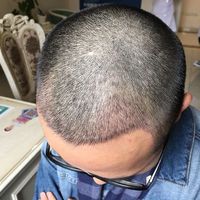 發(fā)際線用戶圖片