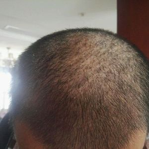 稀少加密分享社区