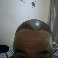 發(fā)際線用戶圖片