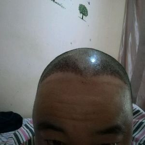 发际线分享社区