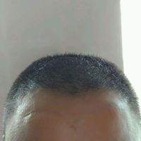 發(fā)際線用戶圖片