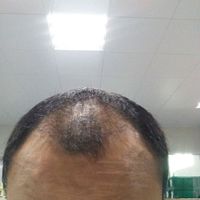 發(fā)際線用戶圖片