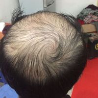 禿頂用戶圖片