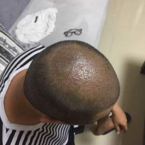 稀少加密分享社区