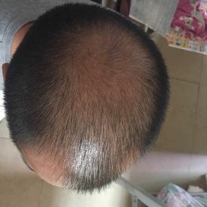 稀少加密分享社区