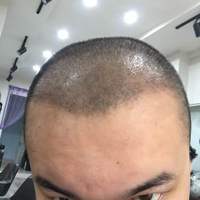 發(fā)際線用戶圖片