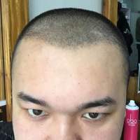 發(fā)際線用戶圖片