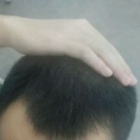 發(fā)際線用戶圖片