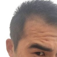 發(fā)際線用戶圖片