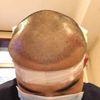 發(fā)際線用戶圖片