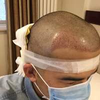 發(fā)際線用戶圖片