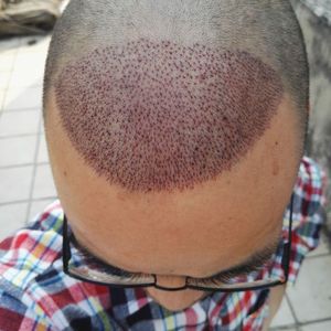稀少加密分享社区