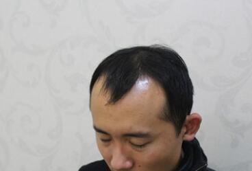 发际线分享社区