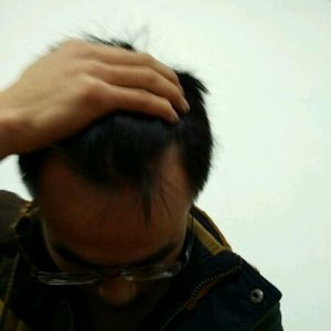 发际线分享社区