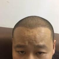 <font color="red">稀少加密</font>用戶圖片